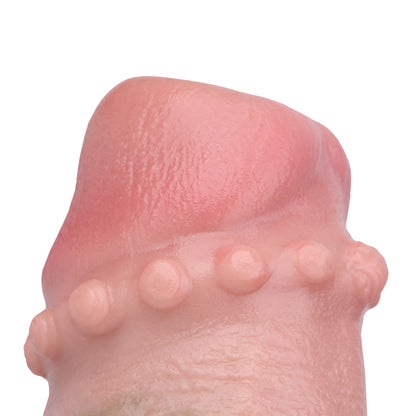 Phimosis Obstructive Loop Penis Sleeve